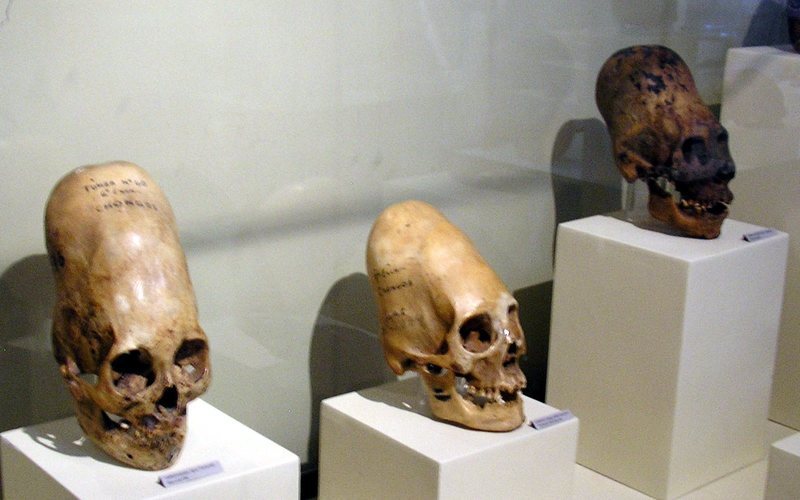 秘鲁伊卡城中伊卡地区博物馆展示的帕拉斯卡头骨（图片来源：Wikimedia Commons）